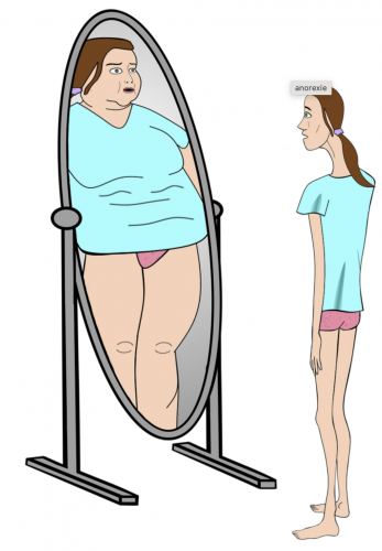 Image Prendre du poids : un défi pour certain·e·s